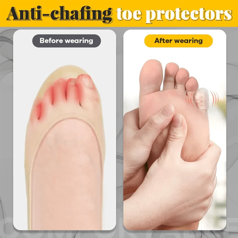 Silicone Anti-Friction Toe Protector (20pcs)