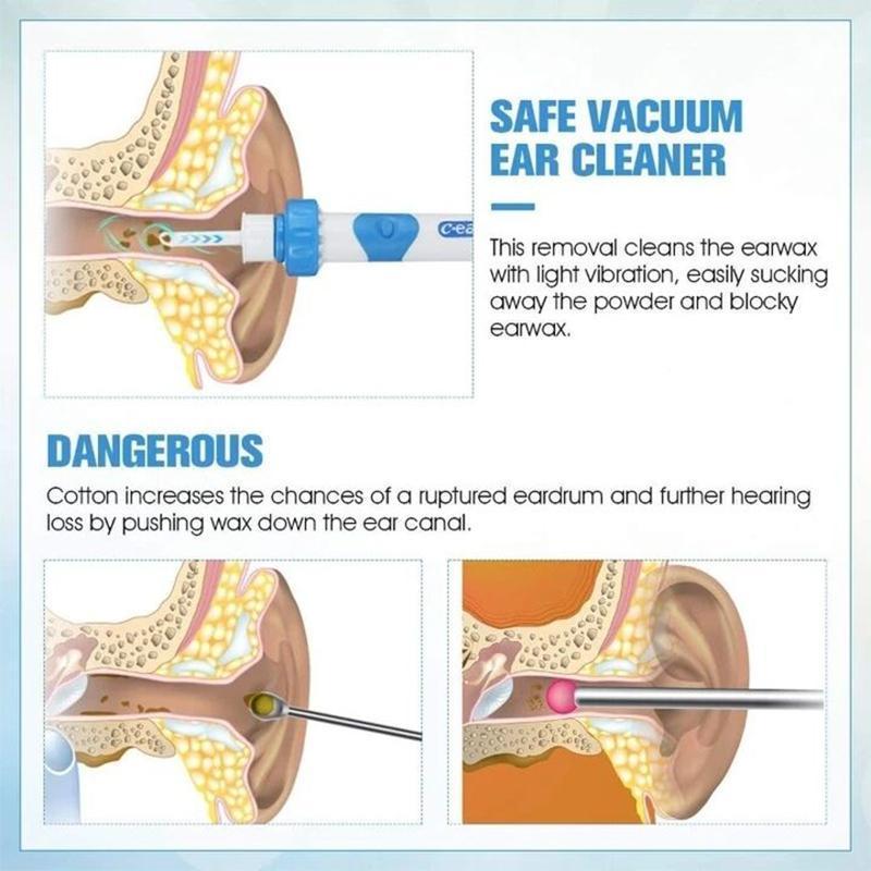 Fanshome™Ear Wax Remover Vacuum Cleaner